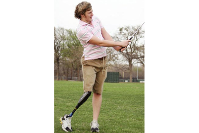 Prótesis de pierna de Batchford Products con cojinetes iglidur®